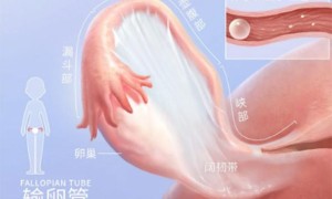 输卵管堵塞只能做试管？先别急，了解这些再做选择